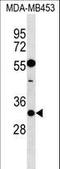 Potassium Voltage-Gated Channel Interacting Protein 2 antibody, LS-C159973, Lifespan Biosciences, Western Blot image 