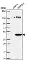 Armadillo Repeat Containing X-Linked 3 antibody, NBP2-55606, Novus Biologicals, Western Blot image 