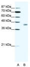 LIM Domain Binding 2 antibody, TA335187, Origene, Western Blot image 