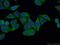 Rab Geranylgeranyltransferase Subunit Alpha antibody, 14448-1-AP, Proteintech Group, Immunofluorescence image 