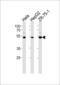 TERF2 Interacting Protein antibody, LS-C161803, Lifespan Biosciences, Western Blot image 