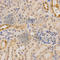 Pyruvate Dehydrogenase E1 Alpha 1 Subunit antibody, A1895, ABclonal Technology, Immunohistochemistry paraffin image 