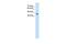 Guanine nucleotide-binding protein G(s) subunit alpha isoforms short antibody, PA5-42230, Invitrogen Antibodies, Western Blot image 