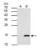 Galectin 7B antibody, GTX121475, GeneTex, Immunoprecipitation image 