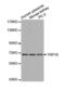 Transient Receptor Potential Cation Channel Subfamily V Member 6 antibody, abx001266, Abbexa, Western Blot image 