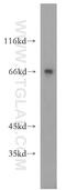 FANCD2 And FANCI Associated Nuclease 1 antibody, 17600-1-AP, Proteintech Group, Western Blot image 