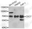 Cell Division Cycle 7 antibody, A5738, ABclonal Technology, Western Blot image 
