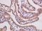 Ret Proto-Oncogene antibody, orb185940, Biorbyt, Immunohistochemistry paraffin image 