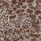 CF Transmembrane Conductance Regulator antibody, NBP1-89315, Novus Biologicals, Immunohistochemistry frozen image 