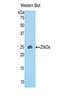 Semaphorin 4B antibody, LS-C296379, Lifespan Biosciences, Western Blot image 