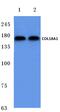 Collagen Type XVIII Alpha 1 Chain antibody, AP06103PU-N, Origene, Western Blot image 