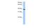 Mitochondrial RRNA Methyltransferase 1 antibody, GTX47251, GeneTex, Western Blot image 