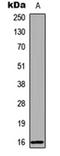 Retinol Binding Protein 5 antibody, orb315683, Biorbyt, Western Blot image 