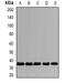 SLAM Family Member 7 antibody, abx142227, Abbexa, Western Blot image 