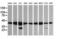 Mitogen-Activated Protein Kinase Kinase 1 antibody, LS-C174648, Lifespan Biosciences, Western Blot image 