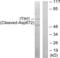 Inter-Alpha-Trypsin Inhibitor Heavy Chain 1 antibody, GTX86920, GeneTex, Western Blot image 