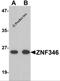 Zinc Finger Protein 346 antibody, 6003, ProSci, Western Blot image 