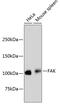 Protein Tyrosine Kinase 2 antibody, 13-926, ProSci, Western Blot image 