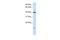 Transmembrane Protein 79 antibody, PA5-43489, Invitrogen Antibodies, Western Blot image 