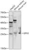 Glutathione Peroxidase 3 antibody, 14-724, ProSci, Western Blot image 