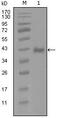 Androgen Receptor antibody, MA5-15455, Invitrogen Antibodies, Western Blot image 