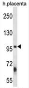 Zinc Finger FYVE-Type Containing 1 antibody, AP54651PU-N, Origene, Western Blot image 