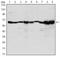 Coactivator Associated Arginine Methyltransferase 1 antibody, NBP2-37645, Novus Biologicals, Western Blot image 
