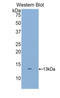 Dickkopf WNT Signaling Pathway Inhibitor 2 antibody, LS-C298963, Lifespan Biosciences, Western Blot image 