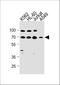 Gamma-Aminobutyric Acid Type A Receptor Theta Subunit antibody, A11195, Boster Biological Technology, Western Blot image 