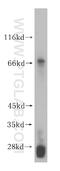 Polypeptide N-Acetylgalactosaminyltransferase 15 antibody, 16900-1-AP, Proteintech Group, Western Blot image 