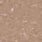 Rho GDP Dissociation Inhibitor Alpha antibody, NBP2-49264, Novus Biologicals, Immunohistochemistry paraffin image 