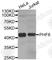 PHD Finger Protein 6 antibody, A6003, ABclonal Technology, Western Blot image 