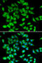 Nuclear Factor Of Activated T Cells 3 antibody, STJ28749, St John