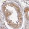 Inhibitor Of Nuclear Factor Kappa B Kinase Subunit Beta antibody, NBP1-87699, Novus Biologicals, Immunohistochemistry frozen image 