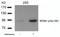 MDM2 Proto-Oncogene antibody, GTX50357, GeneTex, Western Blot image 