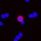 Bone Marrow Stromal Cell Antigen 2 antibody, MAB8660, R&D Systems, Immunocytochemistry image 