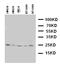 Homeobox A6 antibody, LS-C312760, Lifespan Biosciences, Western Blot image 