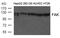 Protein Tyrosine Kinase 2 antibody, 79-584, ProSci, Western Blot image 
