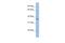 EMI Domain Containing 1 antibody, A15986, Boster Biological Technology, Western Blot image 