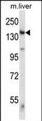 Eukaryotic Translation Initiation Factor 2 Alpha Kinase 4 antibody, PA5-71908, Invitrogen Antibodies, Western Blot image 