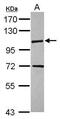 Kinesin Family Member 18A antibody, PA5-31477, Invitrogen Antibodies, Western Blot image 