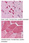 P21 (RAC1) Activated Kinase 2 antibody, MBS194399, MyBioSource, Immunohistochemistry paraffin image 