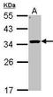 Corticosteroid 11-beta-dehydrogenase isozyme 1 antibody, TA308504, Origene, Western Blot image 