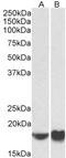 ADP Ribosylation Factor 4 antibody, LS-B9560, Lifespan Biosciences, Western Blot image 