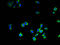 Cathepsin B antibody, A51869-100, Epigentek, Immunofluorescence image 