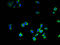 Cathepsin B1 antibody, A51869-100, Epigentek, Immunofluorescence image 