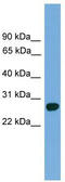 Activator Of Basal Transcription 1 antibody, TA342312, Origene, Western Blot image 