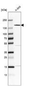 Fibronectin Type III Domain Containing 3B antibody, NBP1-90495, Novus Biologicals, Western Blot image 