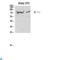 Endoglin antibody, LS-C813847, Lifespan Biosciences, Western Blot image 