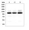 Glutamate Ionotropic Receptor AMPA Type Subunit 2 antibody, PB9205, Boster Biological Technology, Western Blot image 